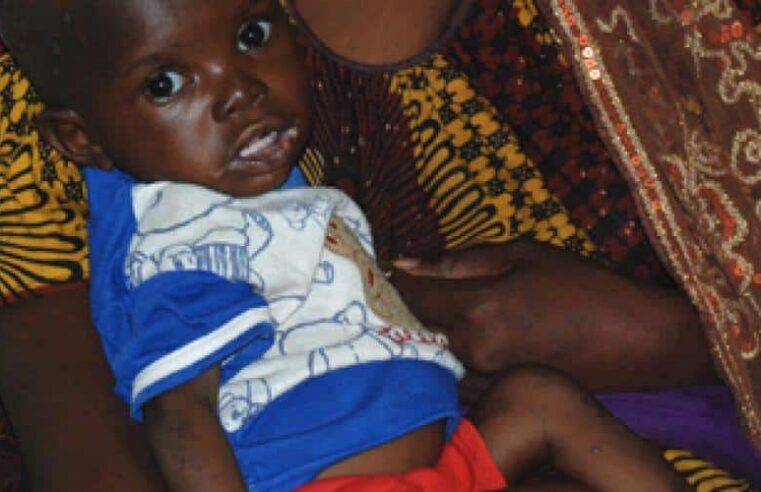 Malnutrition au Mali : enjeux et solutions pour la santé publique