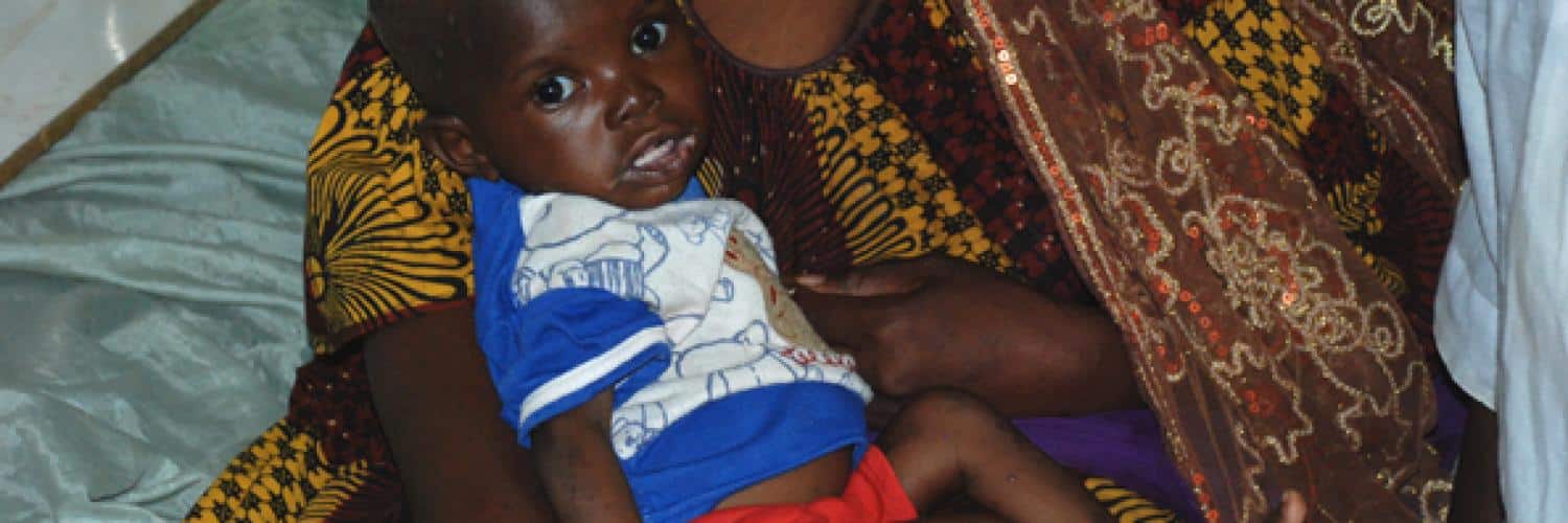 Malnutrition au Mali : enjeux et solutions pour la santé publique